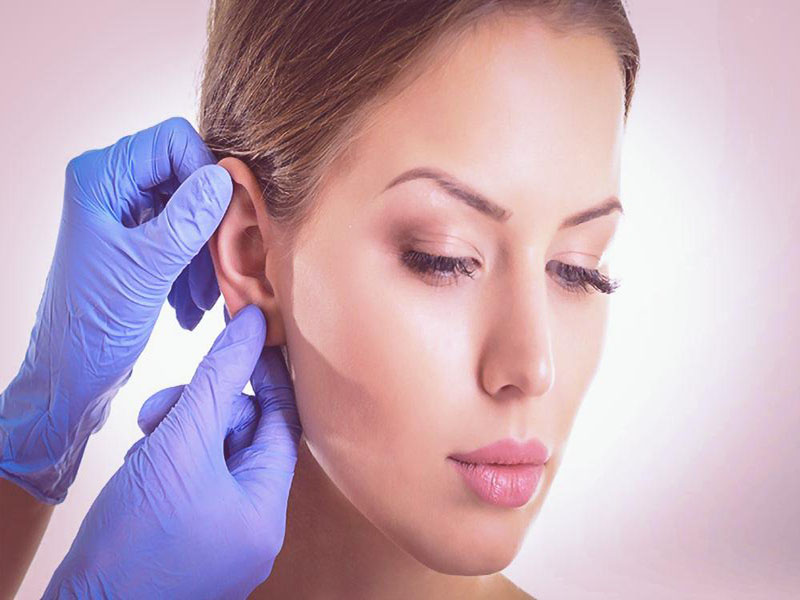 What is OtoPlasty?